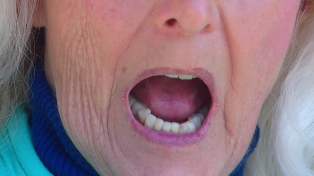 Video Reference: Tooth, Face, Tongue, Facial expression, Lip, Skin, Mouth, Nose, Chin, Close-up