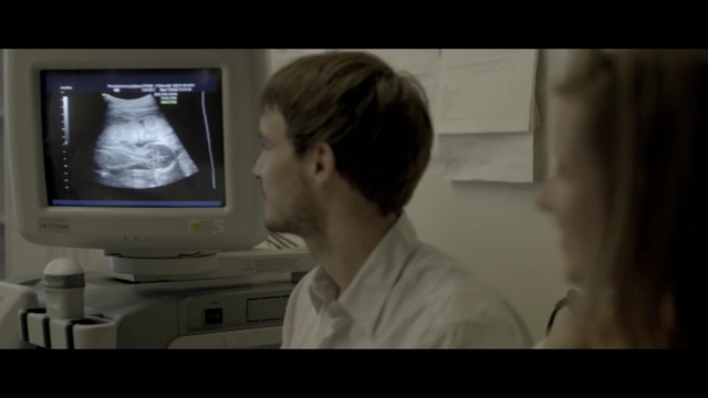 Video Reference: face, medical, technology, service, electronic device, screenshot, medical imaging, medical equipment, jaw, display device, Person