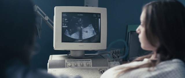 Video Reference: Medical, Screen, Technology, Personal computer, Electronic device, Medical equipment, Service, Output device, Radiology, Computer monitor