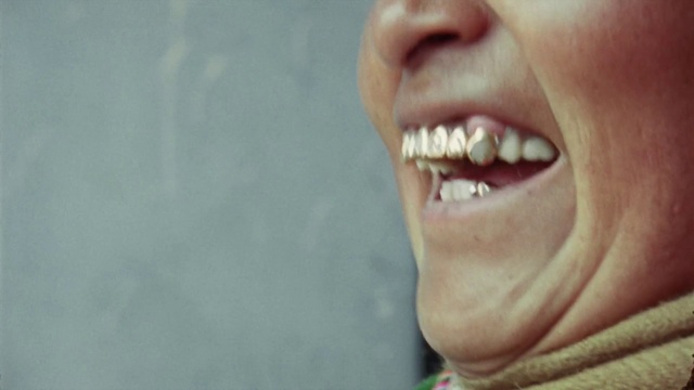 Video Reference: Tooth, Face, Skin, Smile, Lip, Facial expression, Mouth, Jaw, Nose, Chin