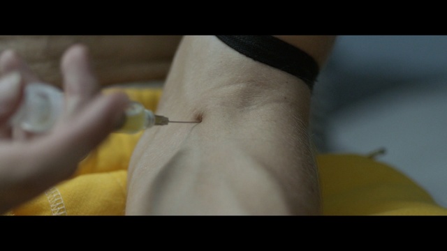 Video Reference: Skin, Hand, Yellow, Finger, Close-up, Joint, Arm, Abdomen, Leg, Trunk