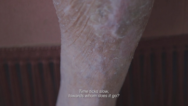 Video Reference: skin, arm, joint