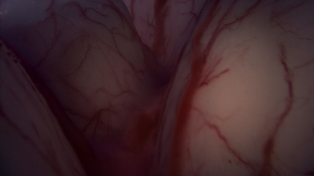 Video Reference: Skin, Red, Close-up, Flesh, Hand, Muscle, Organ, Joint, Eye, Neck