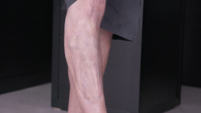 Video Reference: Human leg, Leg, Skin, Arm, Joint, Hand, Knee, Flesh, Thigh, Organ