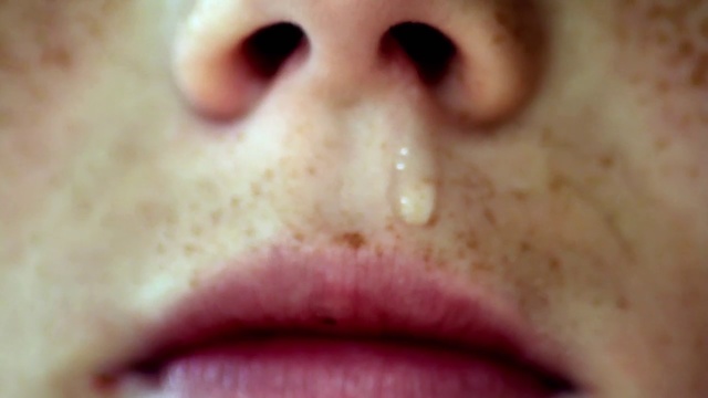 Video Reference: Face, Nose, Lip, Skin, Cheek, Close-up, Mouth, Chin, Head, Jaw