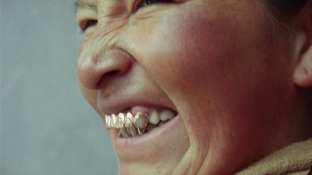 Video Reference: Tooth, Face, Nose, Facial expression, Skin, Smile, Jaw, Mouth, Head, Chin