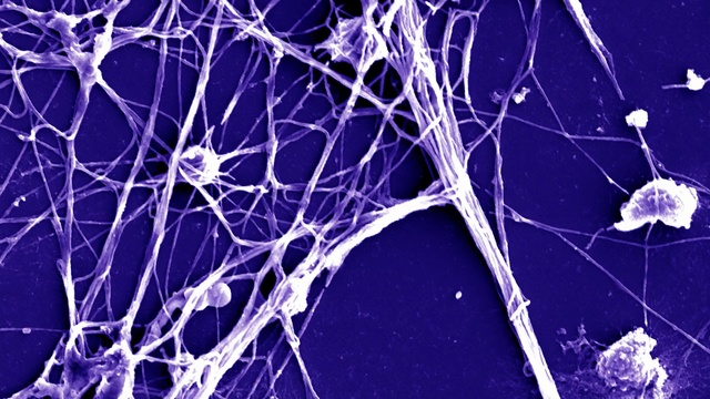 Video Reference: Purple, Branch, Violet, Water, Line, Twig, Tree, Plant, Electric blue