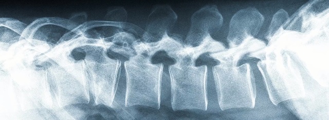 Video Reference: X-ray, Radiography, Radiology, Medical radiography, Medical, Joint, Service, Medical imaging, Bone, Radiologic technologist