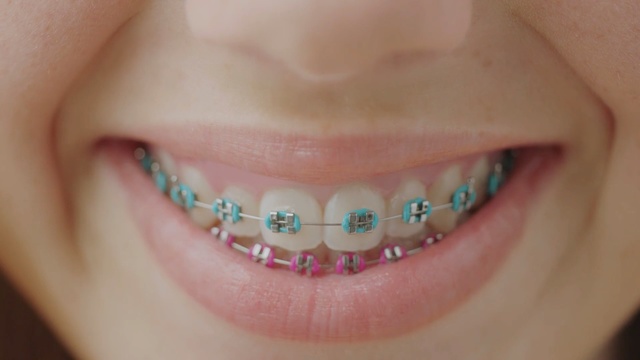 Video Reference: tooth, chin, lip, jaw, close up, cheek, smile, mouth, nail, dentistry