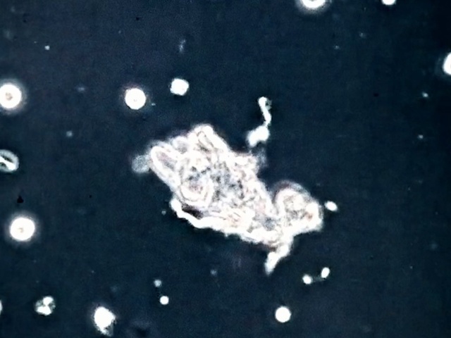 Video Reference: Water, Organism, Astronomical object, Space, Outer space, Rotifer, Amphibian