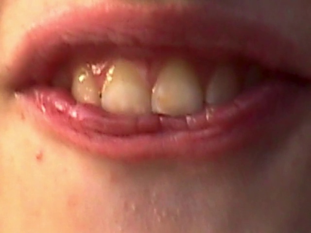 Video Reference: Tooth, Lip, Skin, Mouth, Cheek, Jaw, Close-up, Organ, Chin, Tongue