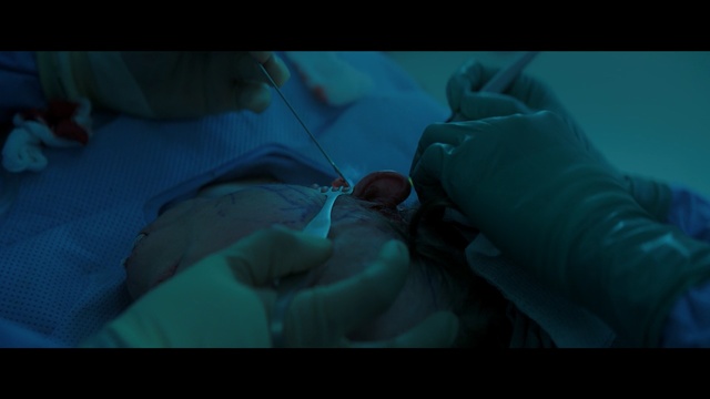 Video Reference: blue, underwater, vertebrate, screenshot, snapshot, azure, surgeon, organism, medical, mouth