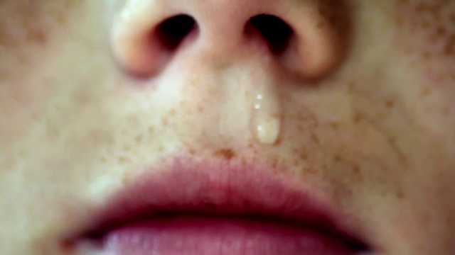 Video Reference: Face, Nose, Lip, Skin, Cheek, Close-up, Mouth, Chin, Head, Jaw