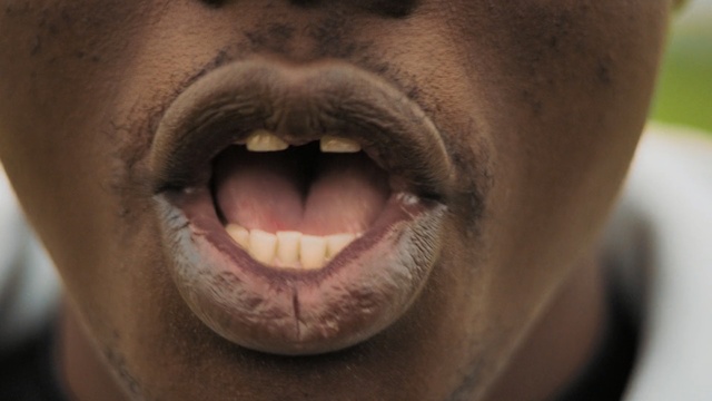 Video Reference: Face, Lip, Skin, Nose, Mouth, Close-up, Facial expression, Tooth, Wrinkle, Cheek