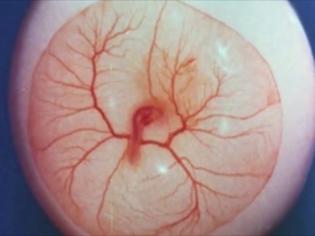 Video Reference: Shoulder, Skin, Joint, Close-up, Nose, Organ, Flesh, Eye, Nerve, Vein