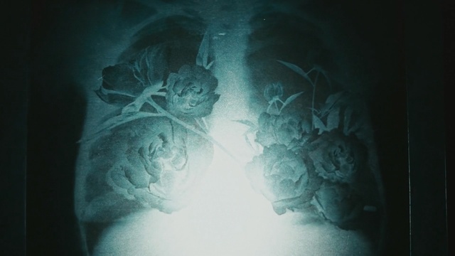 Video Reference: Blue, Shoulder, Joint, Photography, Medical, X-ray, Jaw, Radiography, Darkness
