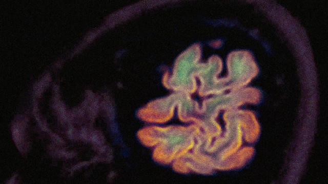 Video Reference: Purple, Organism, Symbol, Pattern, Graphics