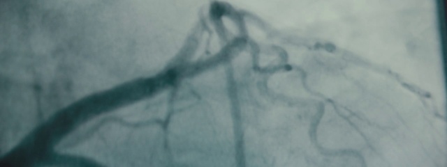 Video Reference: Branch, Twig, Grey, Wood, Tints and shades, Art, Tree, Wire, Freezing, Electric blue