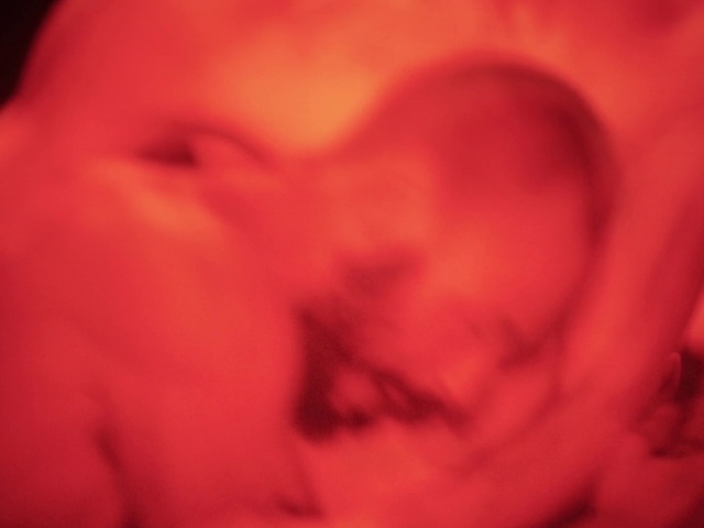 Video Reference: Eyelash, Human body, Jaw, Gesture, Happy, Smile, Kiss, Petal, Magenta, Event