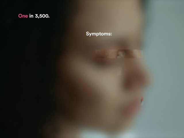 Video Reference: Eyelash, Jaw, Ear, Flash photography, Font, Macro photography, Circle, Darkness, Flesh, Brand