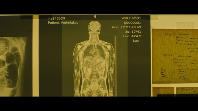 Video Reference: Joint, Arm, Shoulder, Human body, Sleeve, Human anatomy, Organism, Font, Symmetry, Service