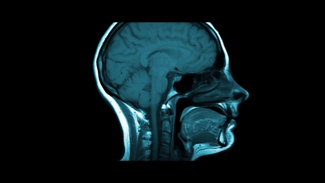 Video Reference: Head, X-ray, Medical imaging, Human body, Jaw, Bone, Medical, Radiology, Radiography, Service