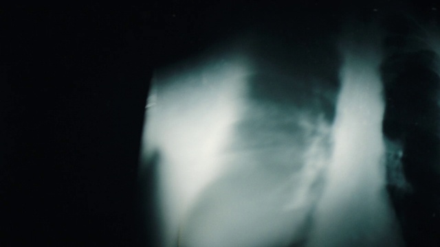 Video Reference: Water, Eye, Cloud, Human body, Plant, Gas, Tints and shades, Flash photography, Tree, Electric blue