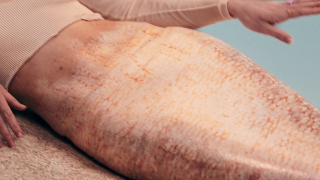 Video Reference: Hand, Leg, Human body, Scar, Gesture, Finger, Knee, Thumb, Nail, Elbow