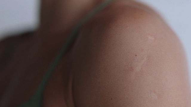 Video Reference: Arm, Human body, Neck, Elbow, Waist, Abdomen, Trunk, Thigh, Eyelash, Knee