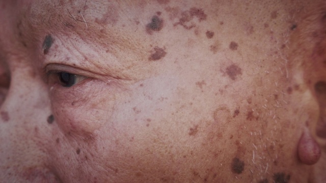 Video Reference: Eyelash, Wrinkle, Wood, Flesh, Peach, Metal, Fur, Freckle, Chest, Abdomen