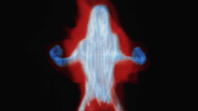 Video Reference: Organism, X-ray, Font, Medical imaging, Medical, Electric blue, Art, Radiology, Symmetry, Event