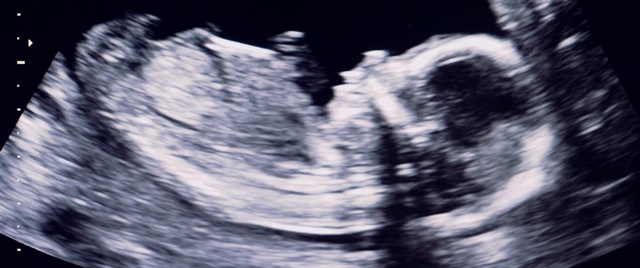 Video Reference: Eye, Cloud, Human body, Natural landscape, Sky, Tree, Font, Cumulus, Electric blue, Monochrome photography