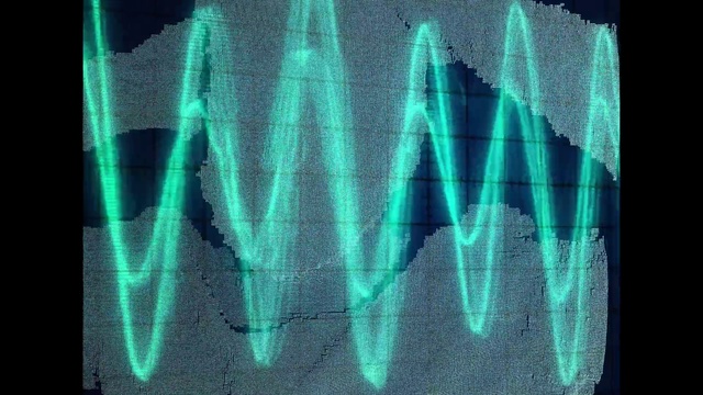 Video Reference: X-ray, Green, Medical, Medical imaging, Radiography, Font, Radiology, Service, Electric blue, Medical radiography