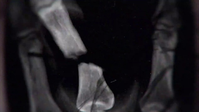 Video Reference: Jaw, Gesture, Grey, Tints and shades, Flash photography, Font, Electric blue, Monochrome photography, Darkness, Auto part