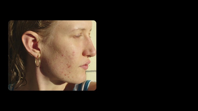 Video Reference: Forehead, Nose, Cheek, Lip, Shoulder, Eyelash, Mouth, Ear, Neck, Flash photography