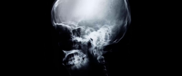 Video Reference: Human body, Jaw, Medical, Bone, Gas, Radiography, Service, Electric blue, Medical imaging, Transparent material