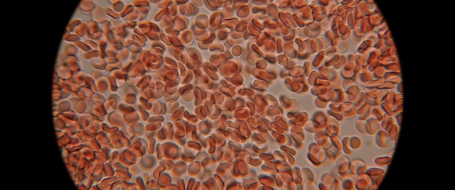 Video Reference: Orange, Underwater, Marine invertebrates, Marine biology, Pattern, Peach, Cuisine, Close-up, Metal, Circle