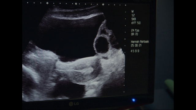 Video Reference: Medical imaging, Human body, Radiography, Medical, Obstetric ultrasonography, Radiology, Service, Bone, Medical radiography, X-ray