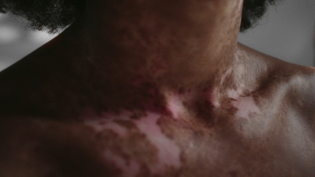 Video Reference: Eyebrow, Eyelash, Human body, Jaw, Neck, Chest, Tints and shades, Wood, Beard, Whiskers