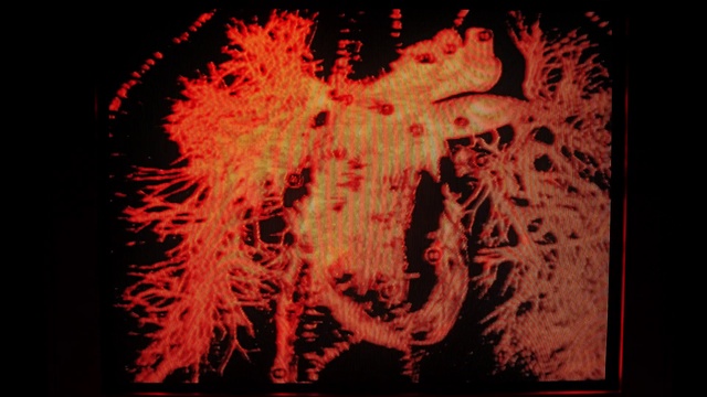 Video Reference: Organism, Art, Font, Symmetry, Rectangle, Pattern, Event, Visual arts, Graphics, Graphic design