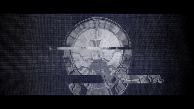 Video Reference: Font, Circle, Pattern, Art, Technology, Symmetry, Monochrome photography, Monochrome, Display device, Medical