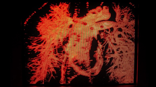 Video Reference: Organism, Art, Font, Symmetry, Event, Pattern, Rectangle, Visual arts, Graphics, Creative arts