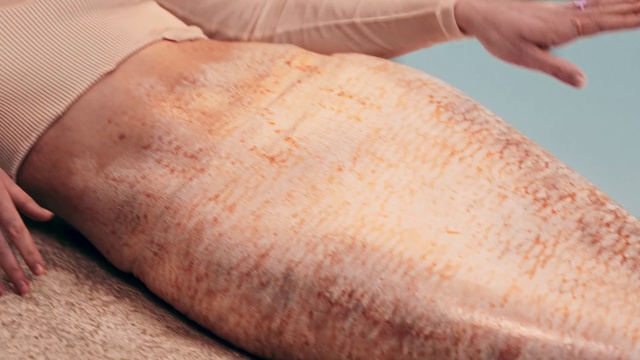 Video Reference: Hand, Arm, Leg, Human body, Scar, Gesture, Finger, Knee, Thumb, Nail