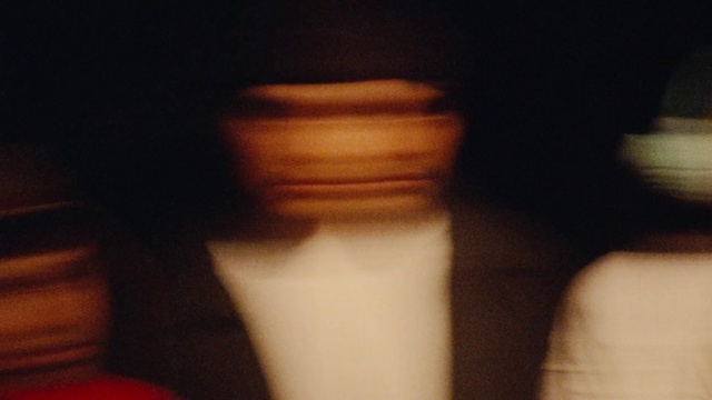 Video Reference: Jaw, Bone, Gesture, Tints and shades, Human leg, Wrist, X-ray, Medical imaging, Radiography, Medical