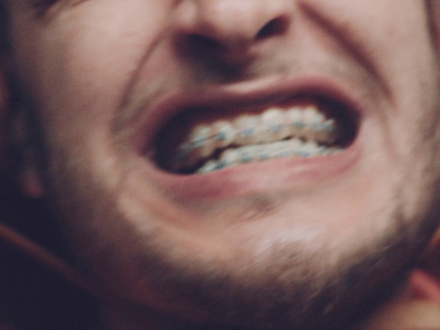 Video Reference: Jaw, Tooth, Eyelash, Gesture, Happy, Wrinkle, Facial hair, Moustache, Flesh, Laugh