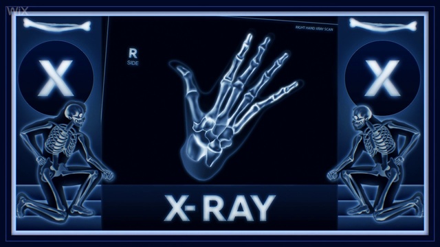 Video Reference: Medical imaging, Gesture, Font, Radiology, X-ray, Display device, Technology, Radiography, Electric blue, Medical