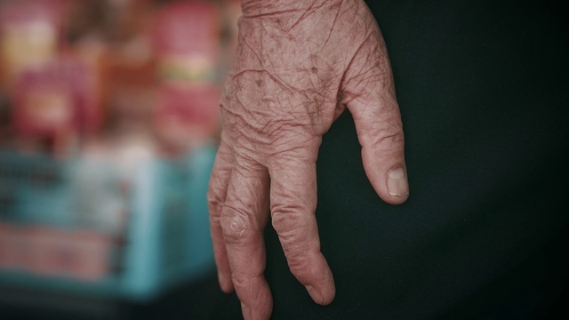 Video Reference: Skin, Gesture, Finger, Thumb, Wrinkle, Wrist, Nail, Blood vessel, Nerve, Human leg