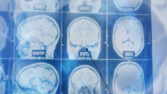 Video Reference: White, Light, Medical imaging, X-ray, Medical, Electric blue, Service, Circle, Symmetry, Computed tomography