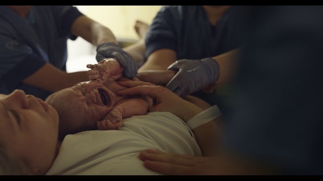 Video Reference: Medical procedure, Health care, Medical, Gesture, Patient, Comfort, Health care provider, Medical equipment, Service, Surgeon