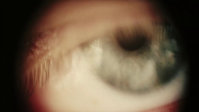 Video Reference: Eyelash, Jaw, Ear, Flash photography, Whiskers, Snout, Chest, Darkness, Fur, Macro photography